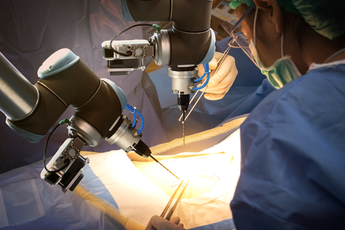 A depiction of doctors using automated robots in an operating room to deliver exacting precision.